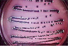 petri2.jpg (16053 bytes)